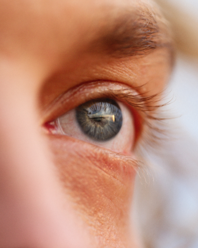 الودگی هوا چشم ها